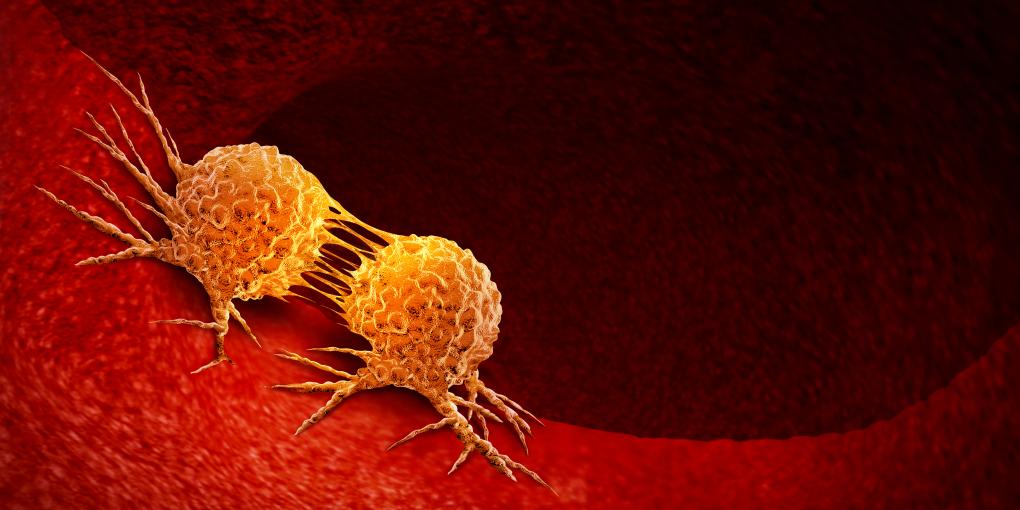Cancer cell image Cancer cell