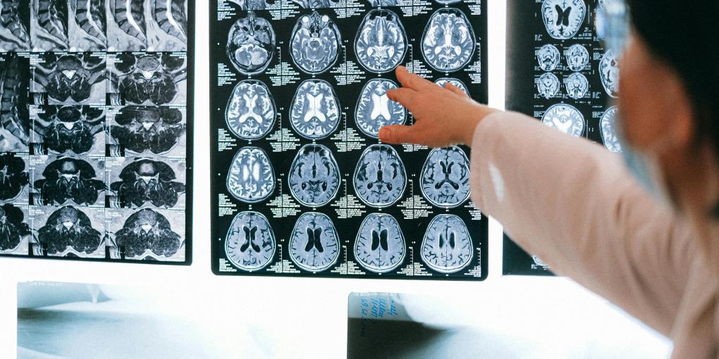 Brain scan Brain scan
